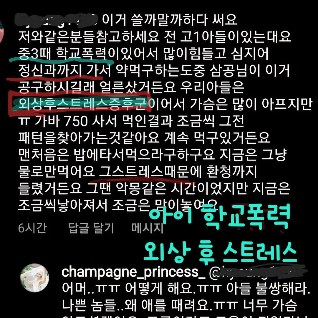 LED 속눈썹 제거제 15