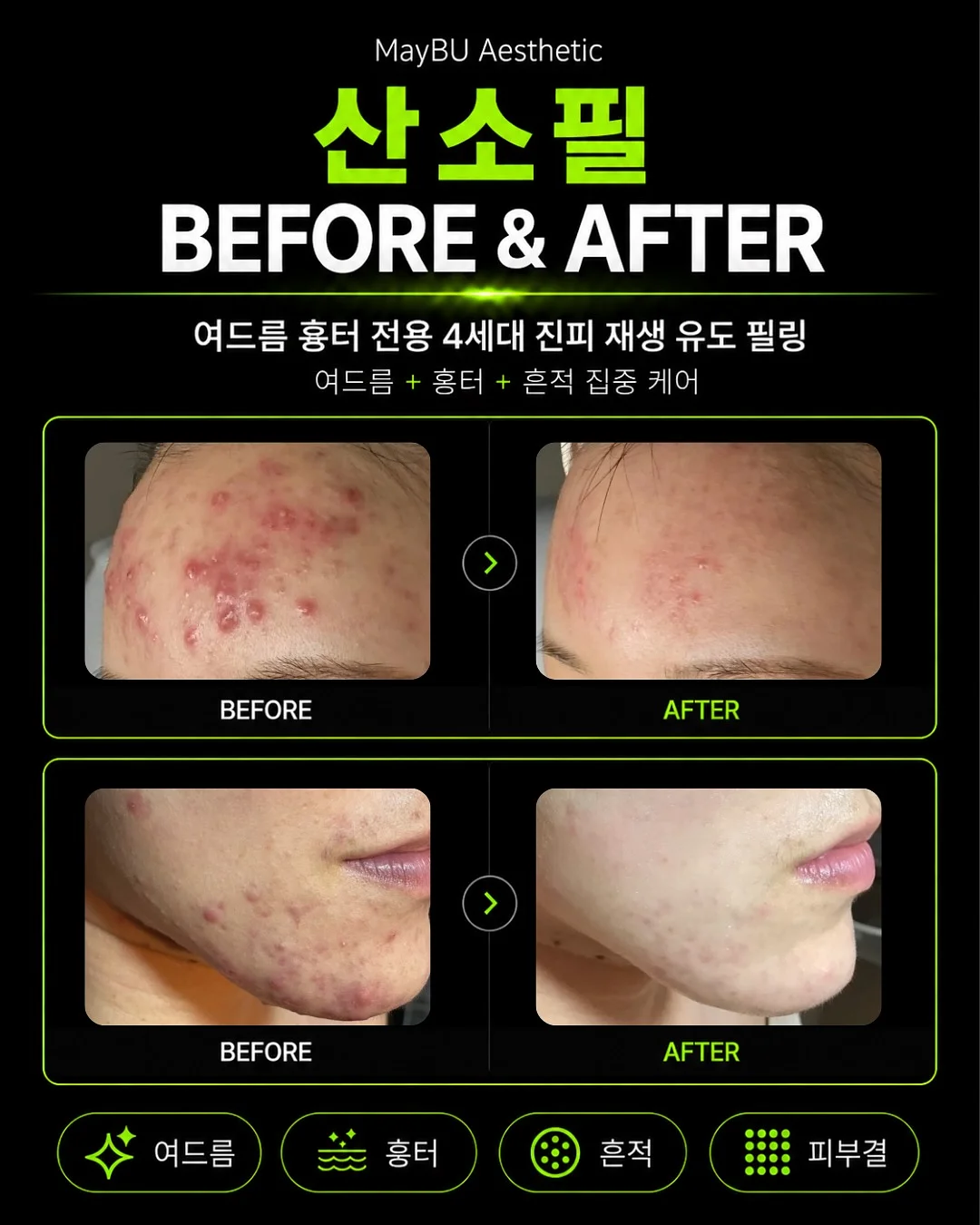 크로톤 1