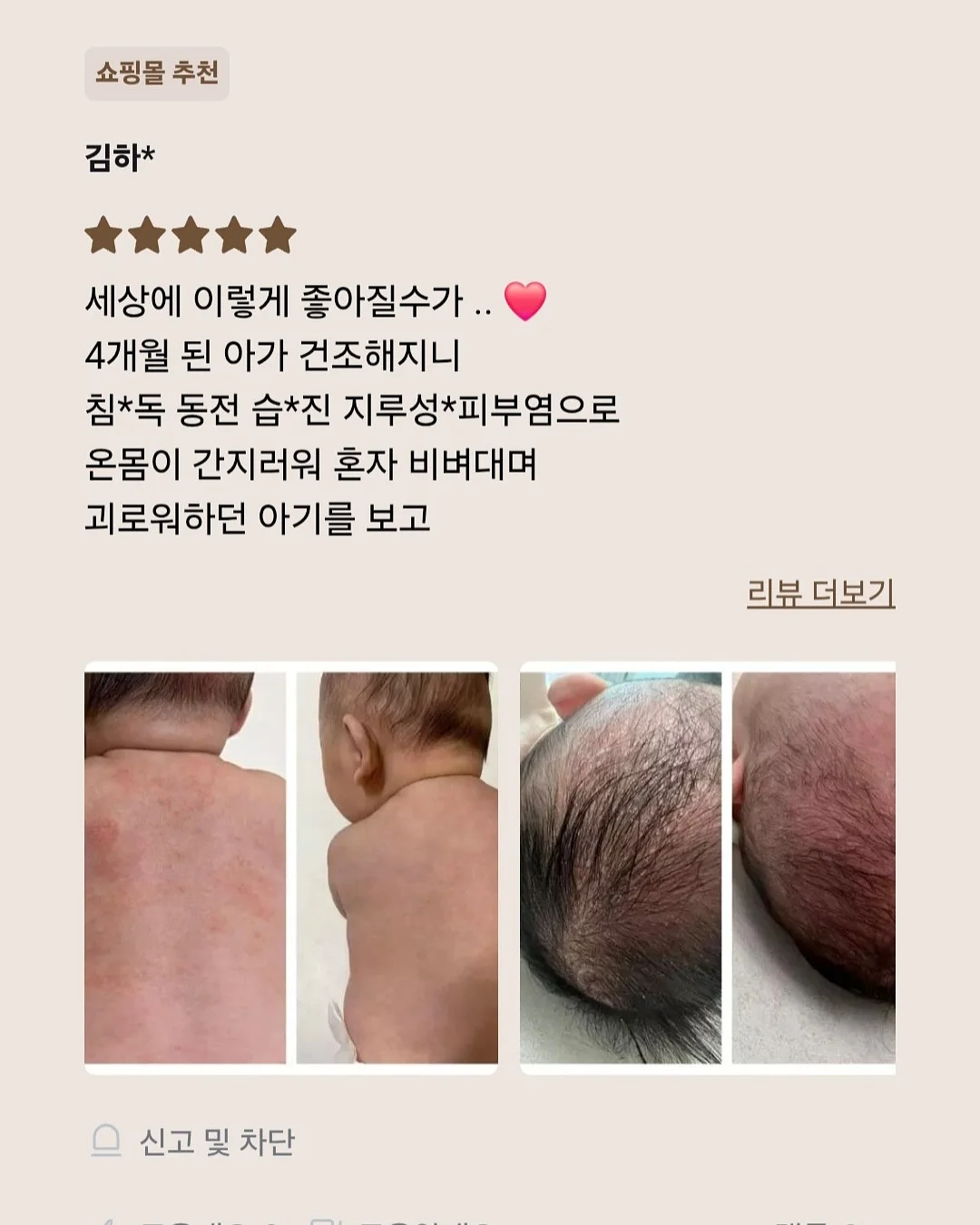오르빗링 11
