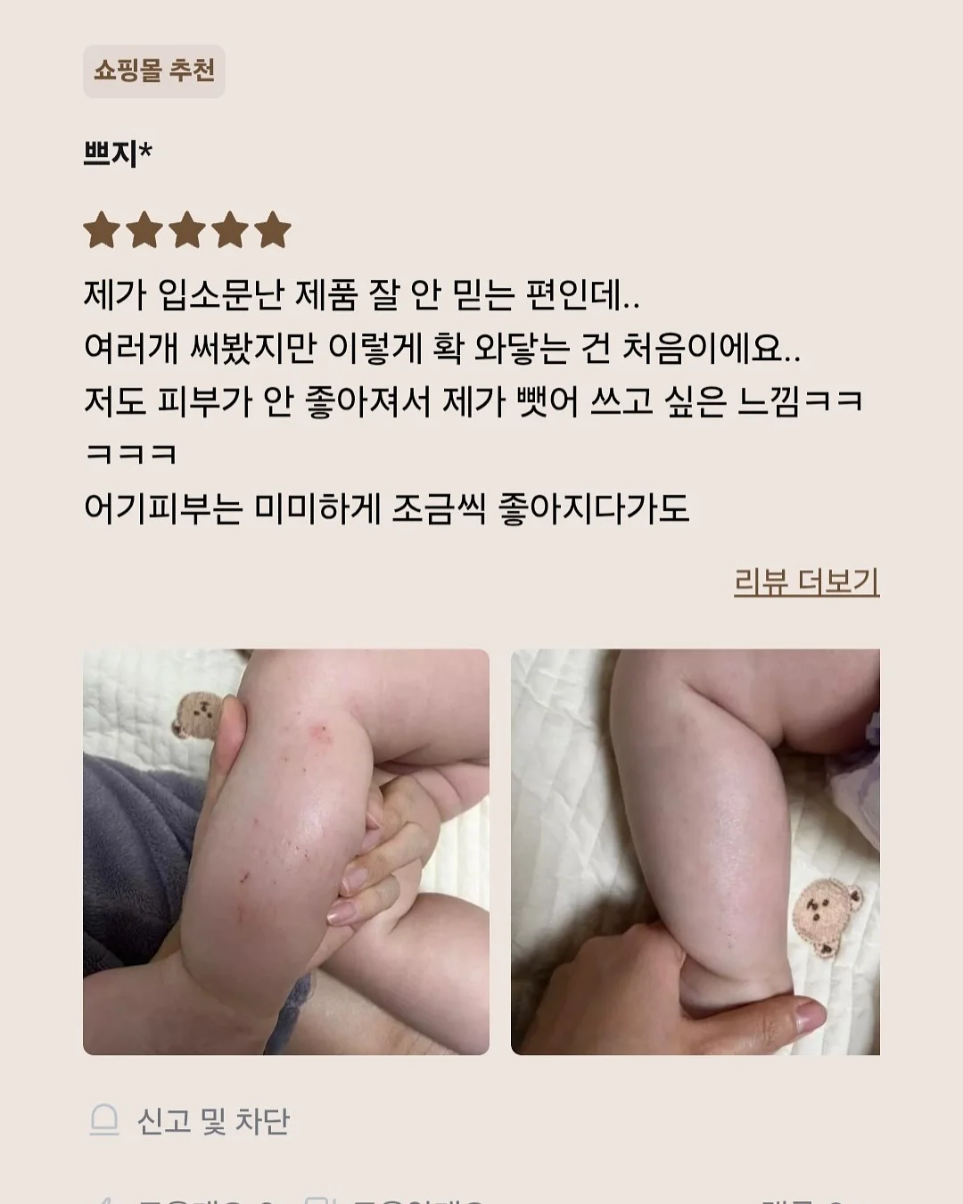 오르빗링 17