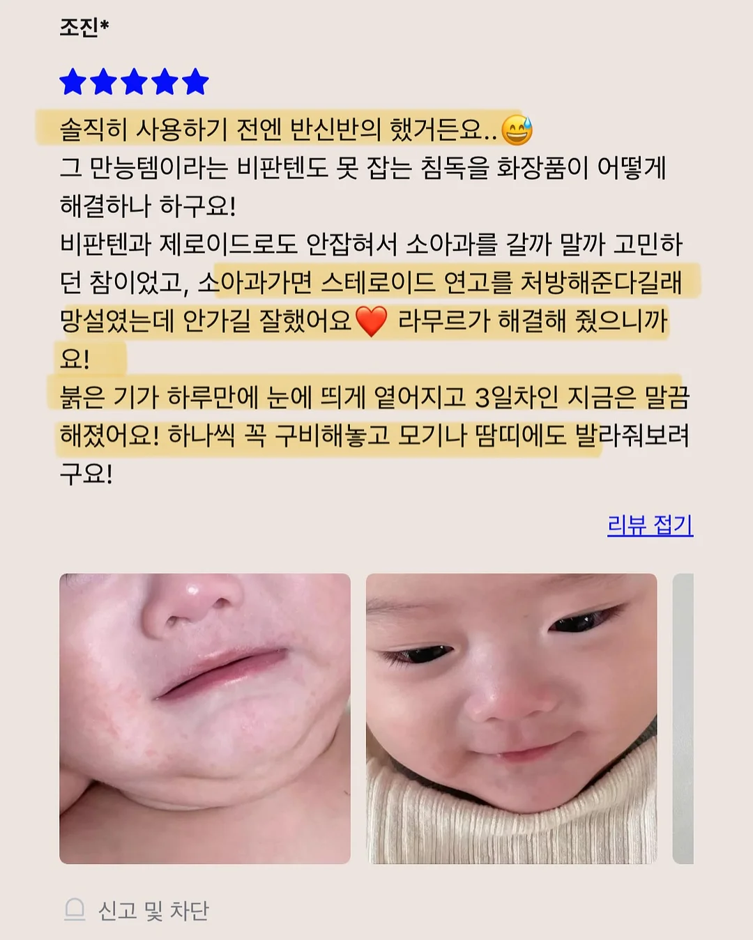 오르빗링 9