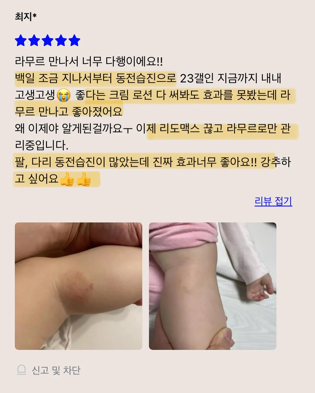 오르빗링 10