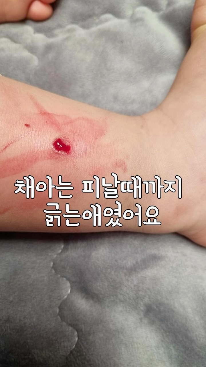 스트라이프 패턴