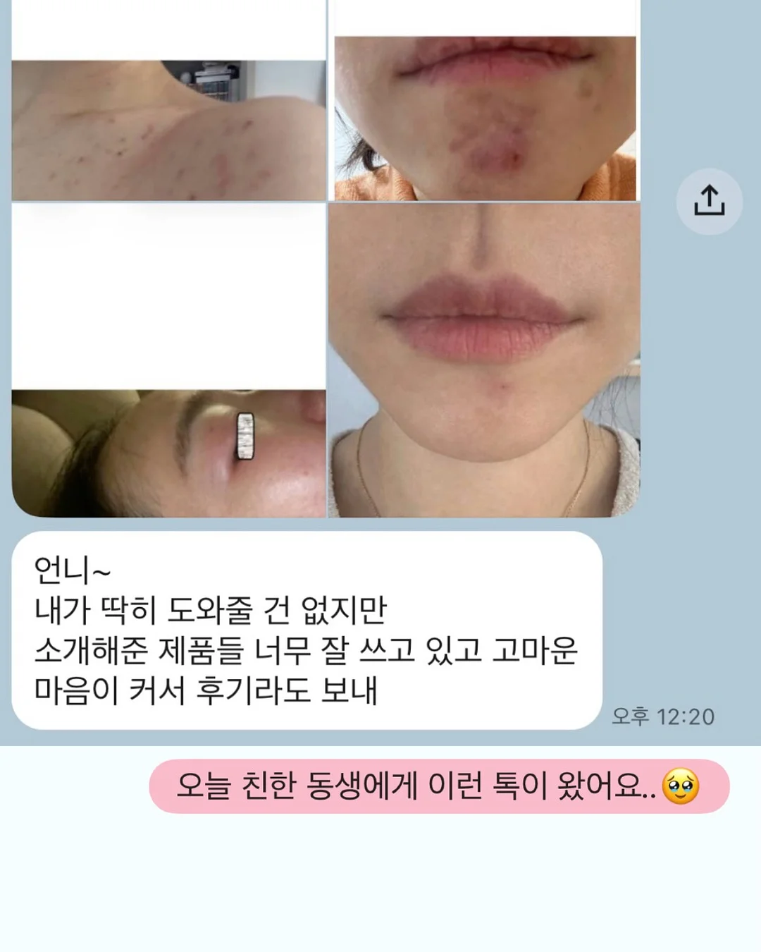 신생아 육아 필수템 1