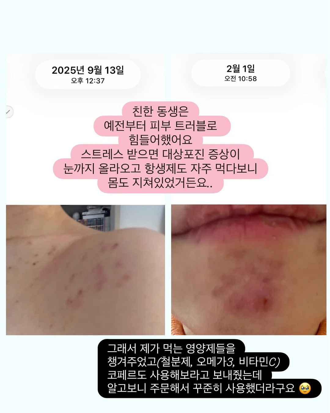 신생아 육아 필수템 4