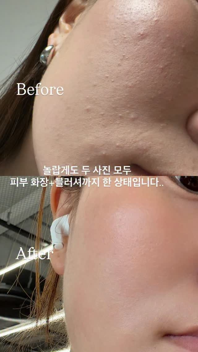 삼각 코너 집게