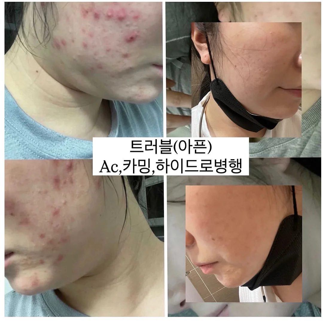 원목 캣휠 9