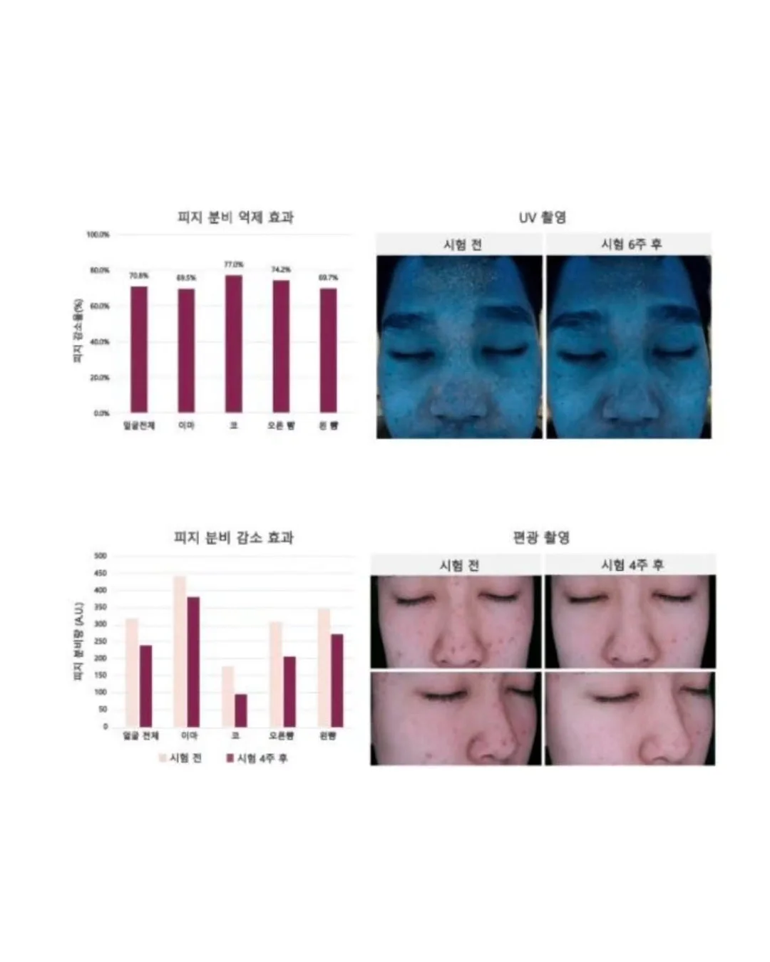 중단발 레이어드펌 8
