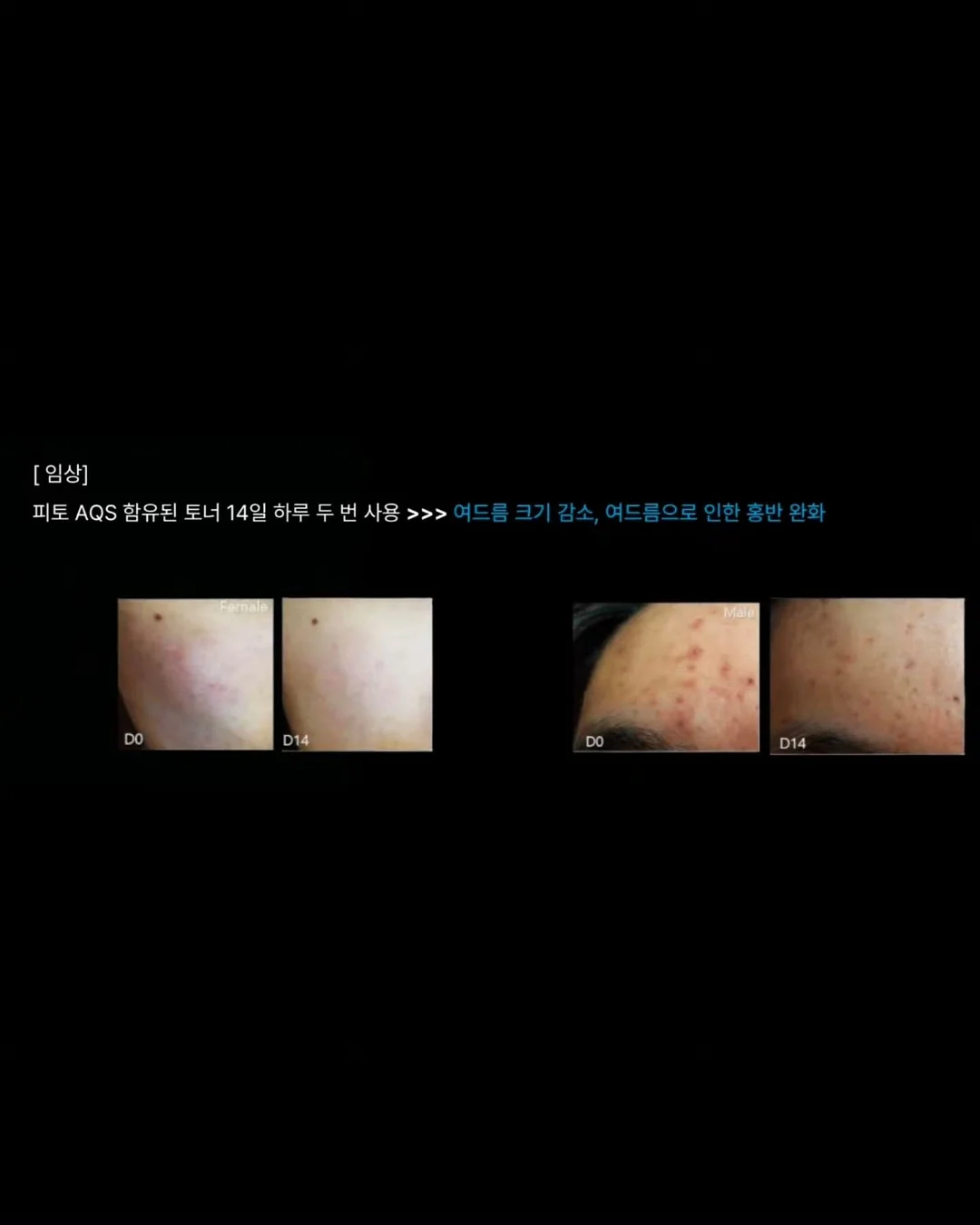 중단발 레이어드펌 9