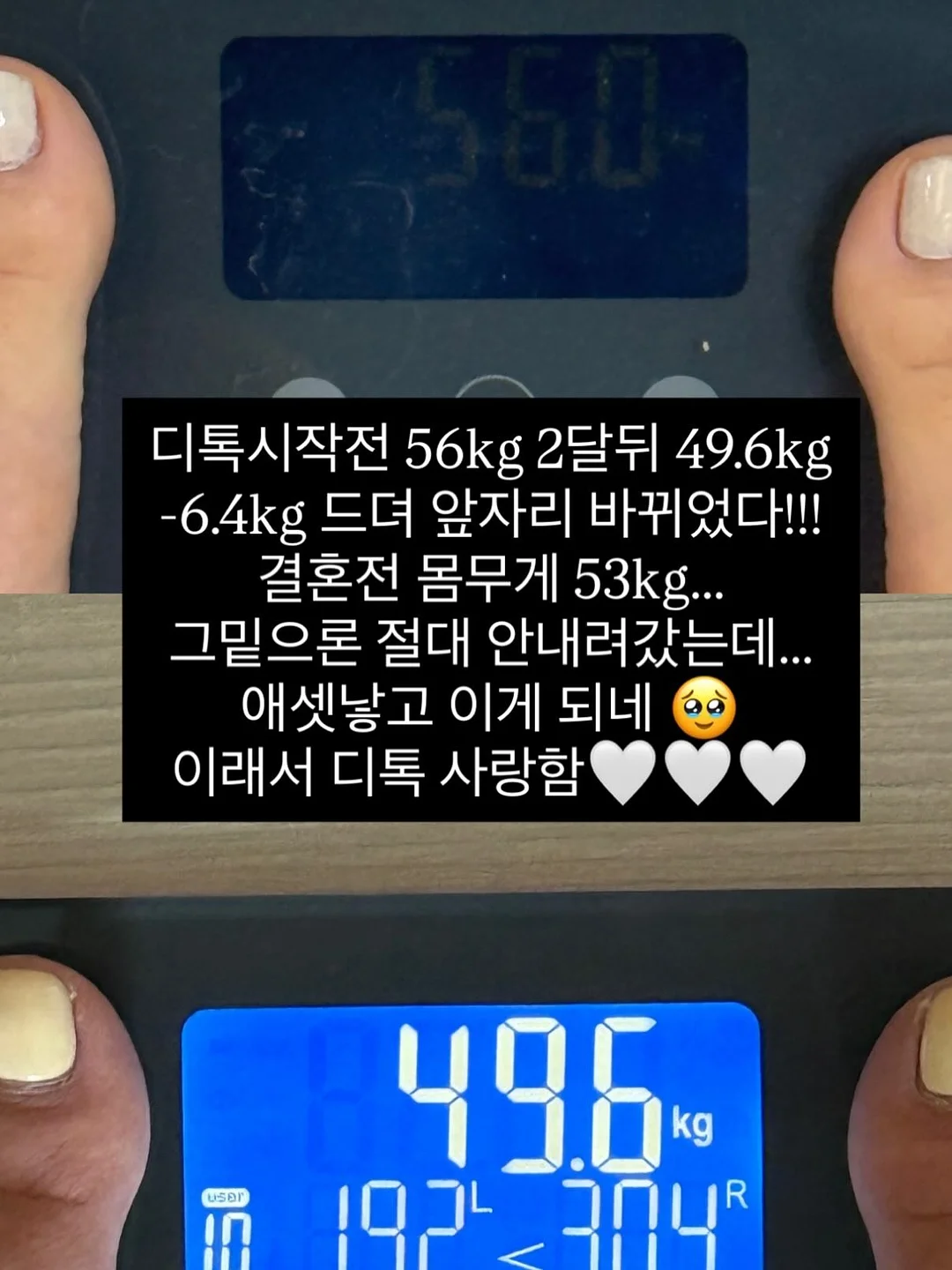 더디 카네이션 선물 13
