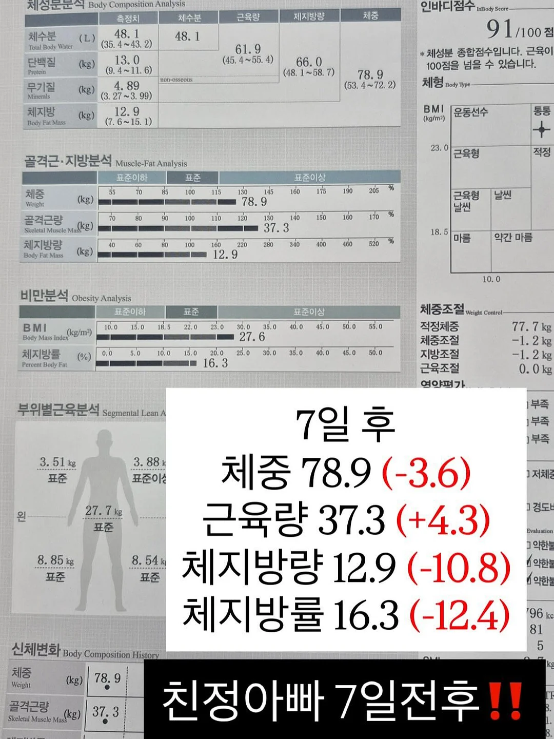 더디 카네이션 선물 7