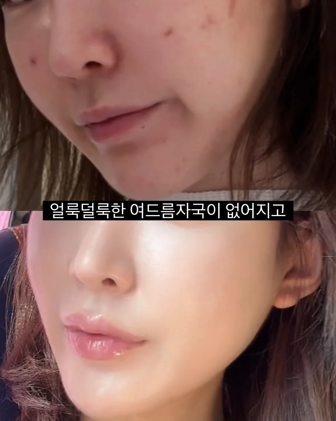 살 빠져보이는 코디 2