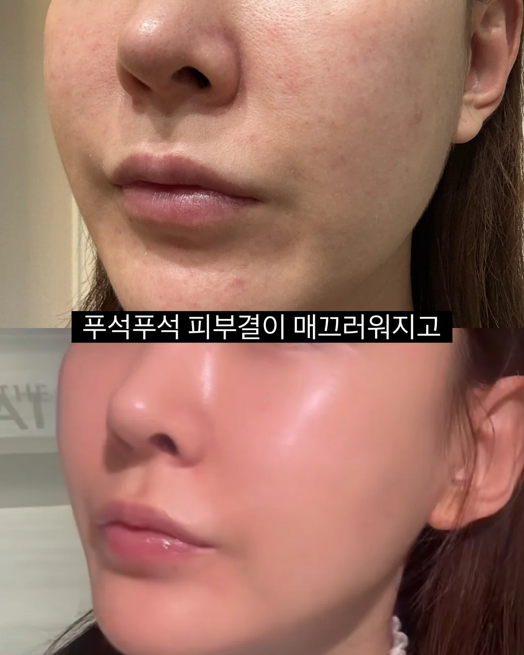살 빠져보이는 코디 4
