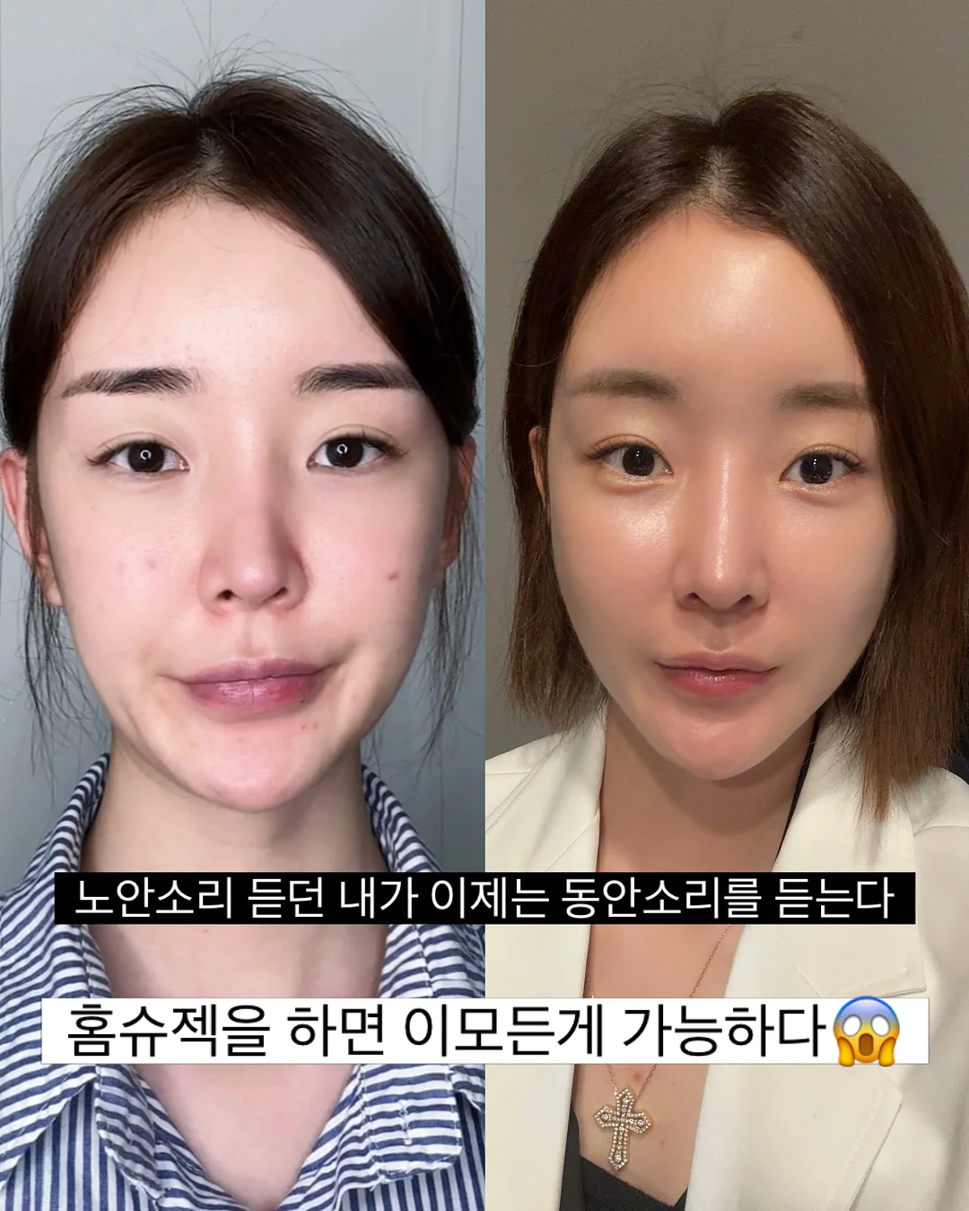 살 빠져보이는 코디 7