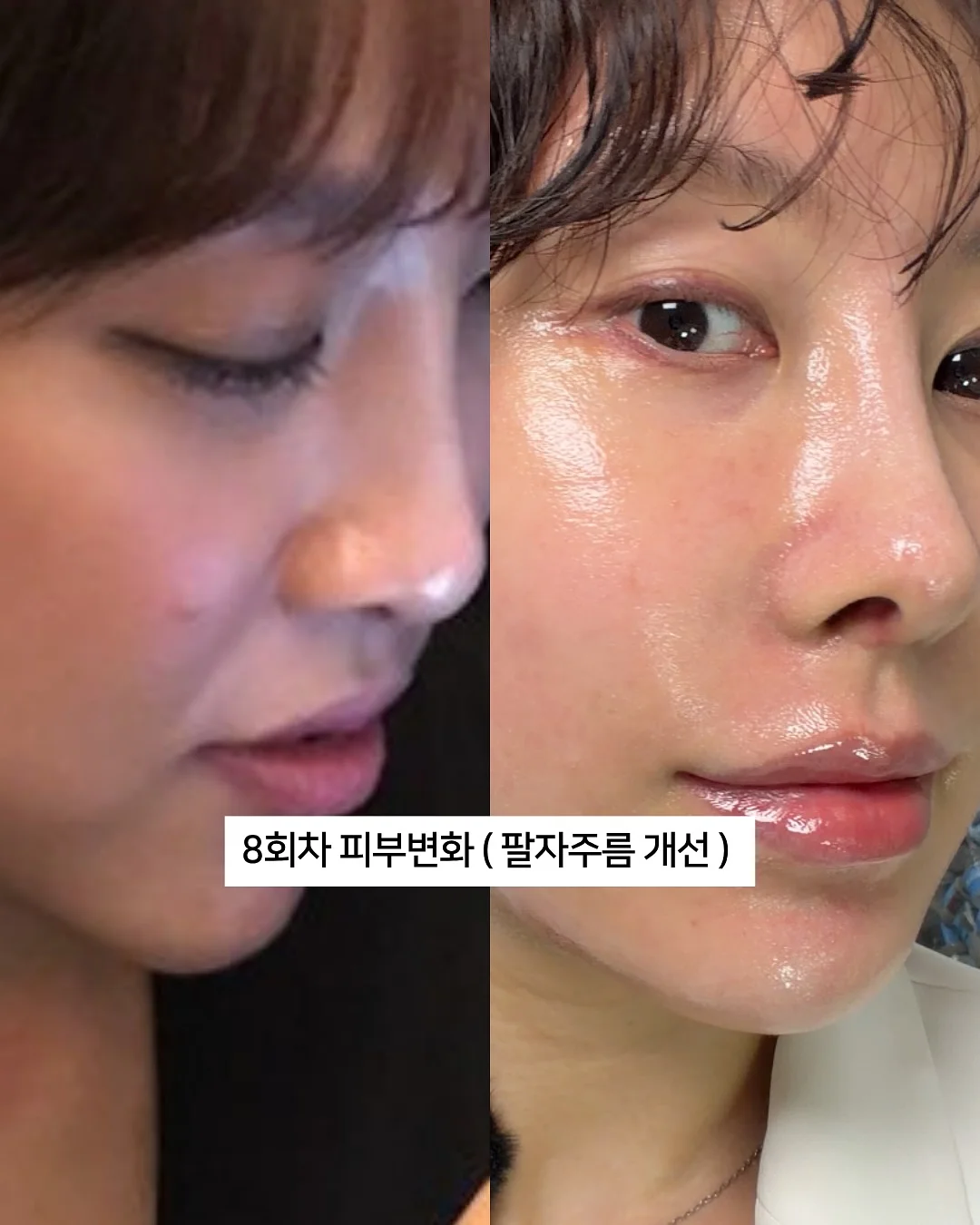 배수구 커버 17