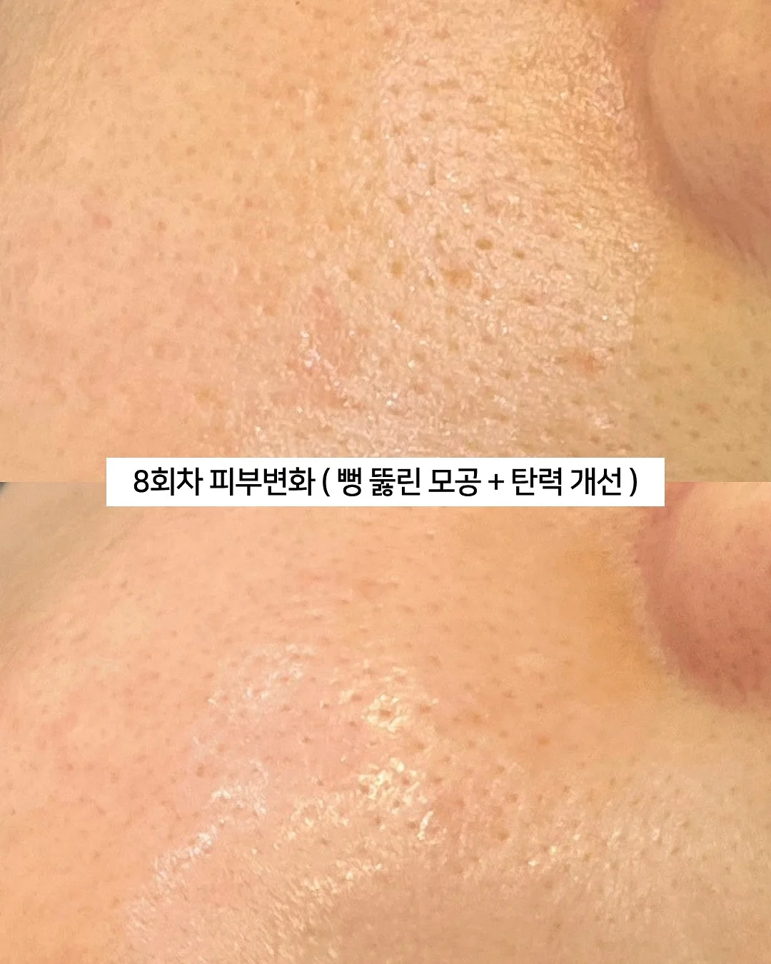 배수구 커버 18