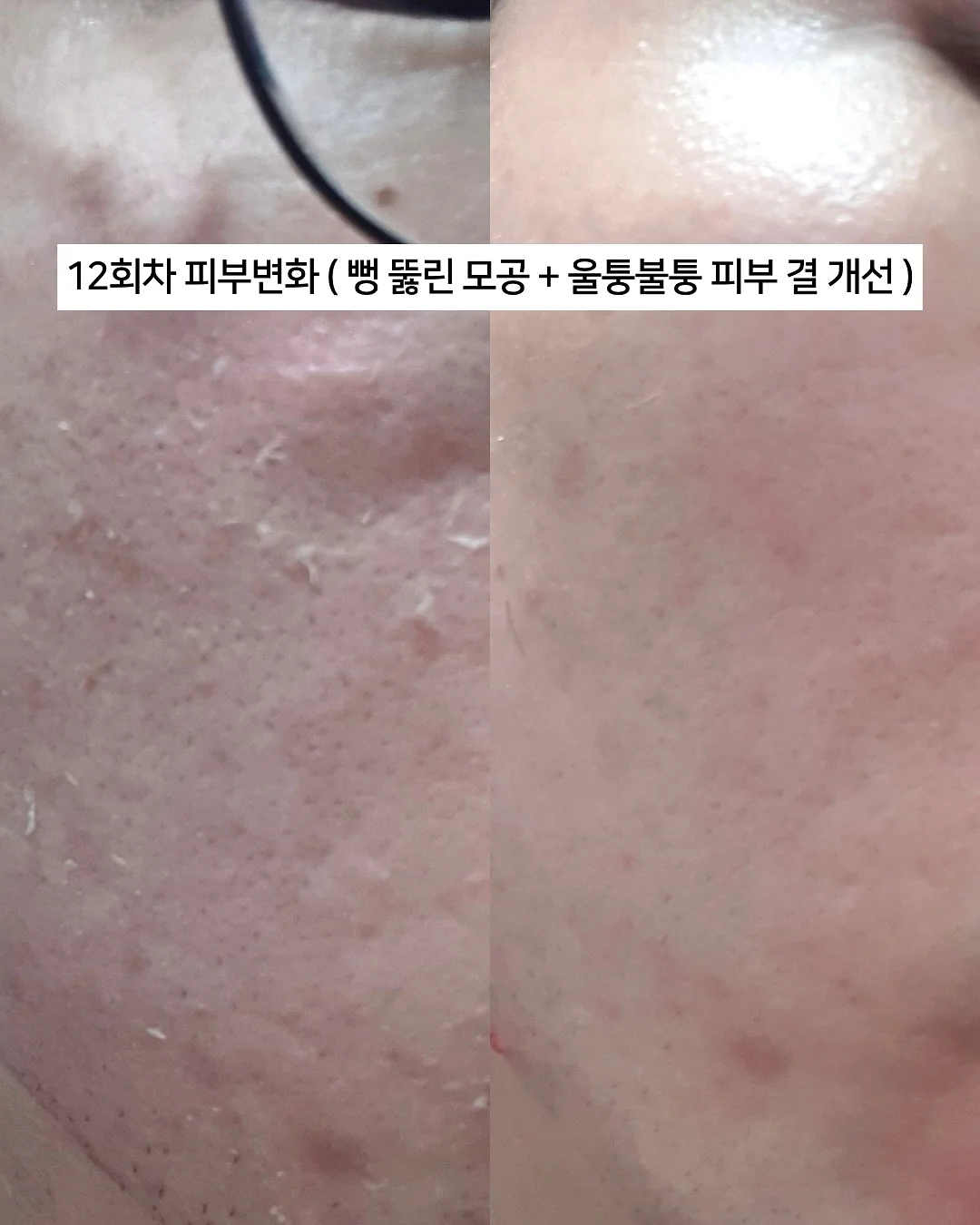 배수구 커버 19