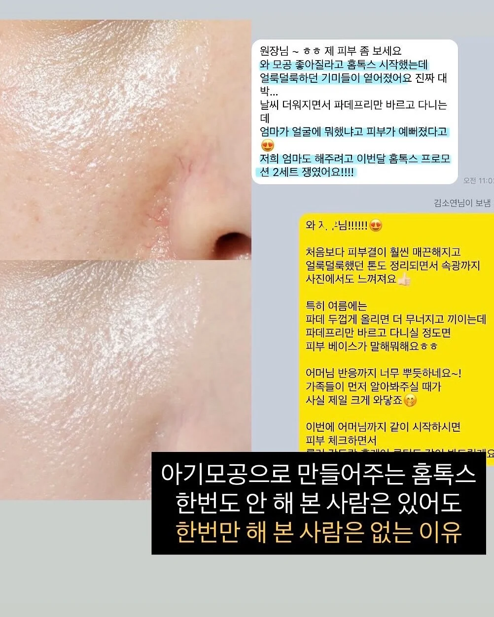 배수구 커버 10