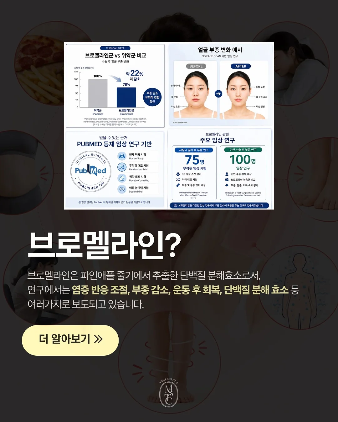 하부장 정리템 4