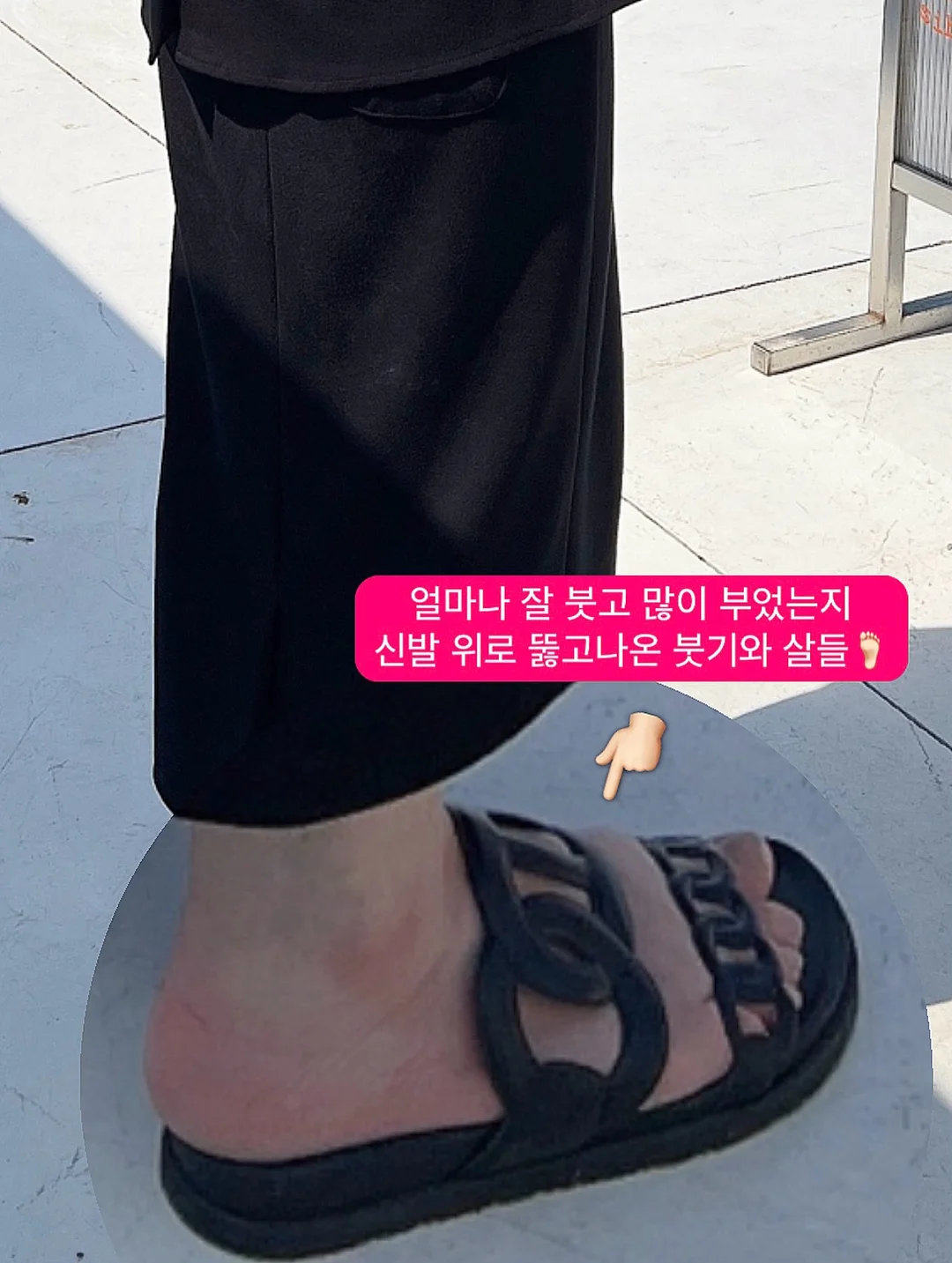 모기퇴치 팔찌 3