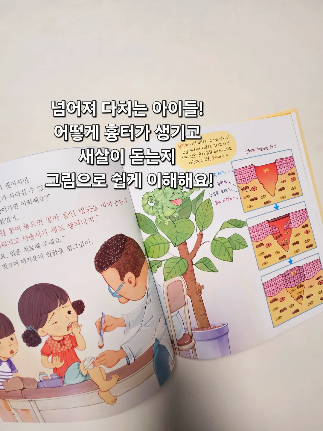 괄사, 목 견인기 3