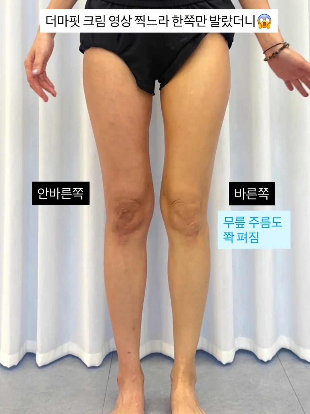 날씨 표현 영어단어 퀴즈 4