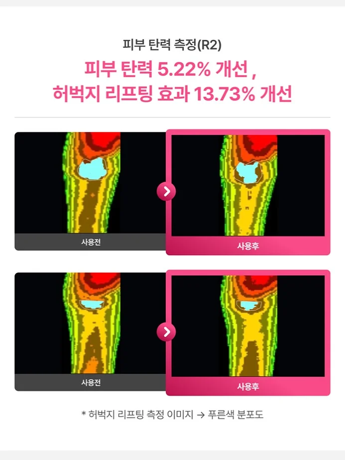 날씨 표현 영어단어 퀴즈 10