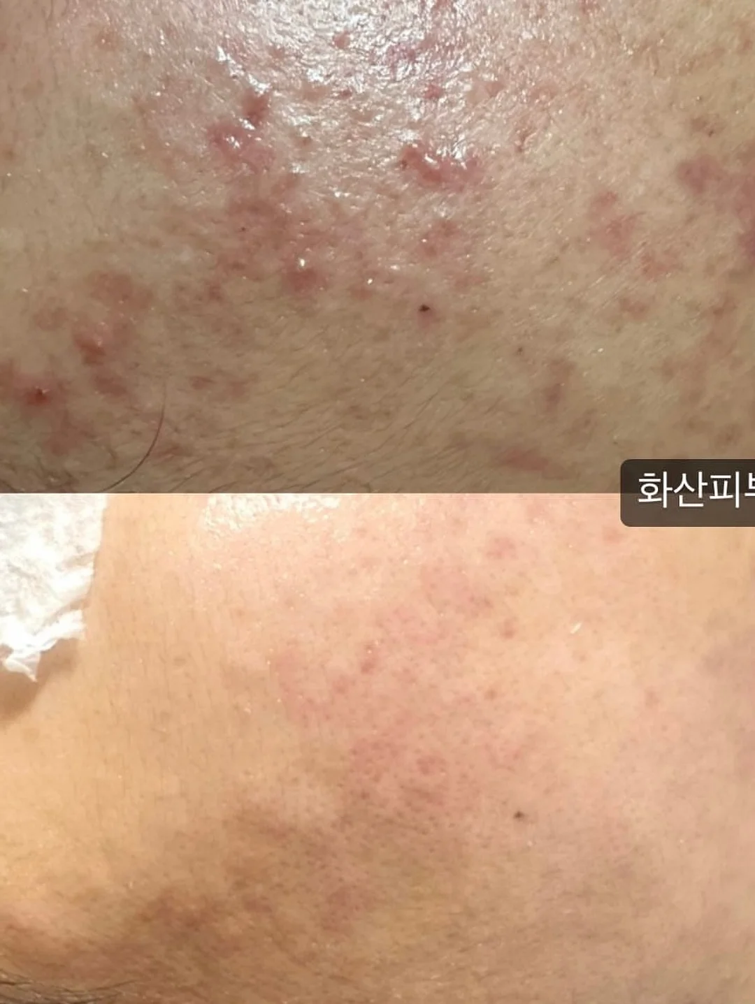 욤포켓스튜디오 믹스원석 미아방지팔찌 11