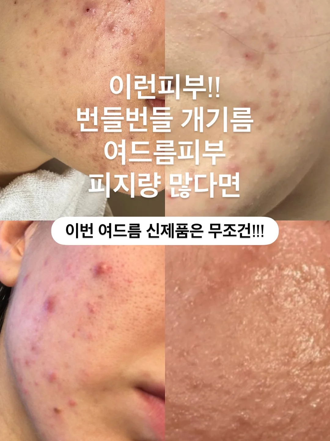 욤포켓스튜디오 믹스원석 미아방지팔찌 2