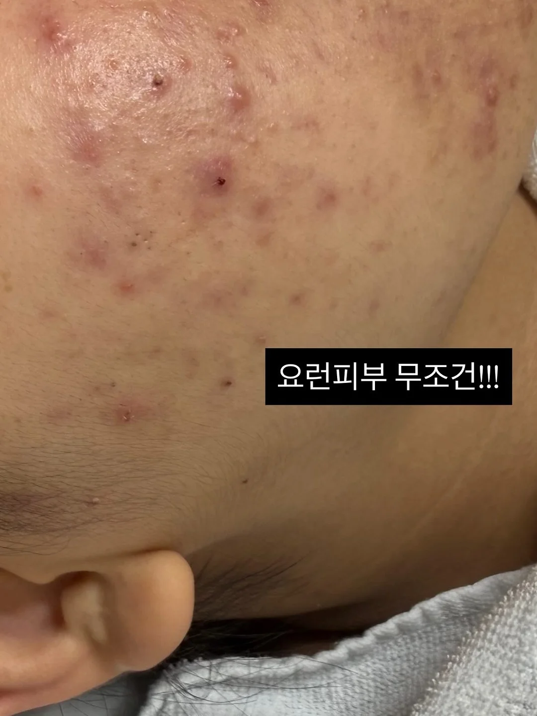 욤포켓스튜디오 믹스원석 미아방지팔찌 9
