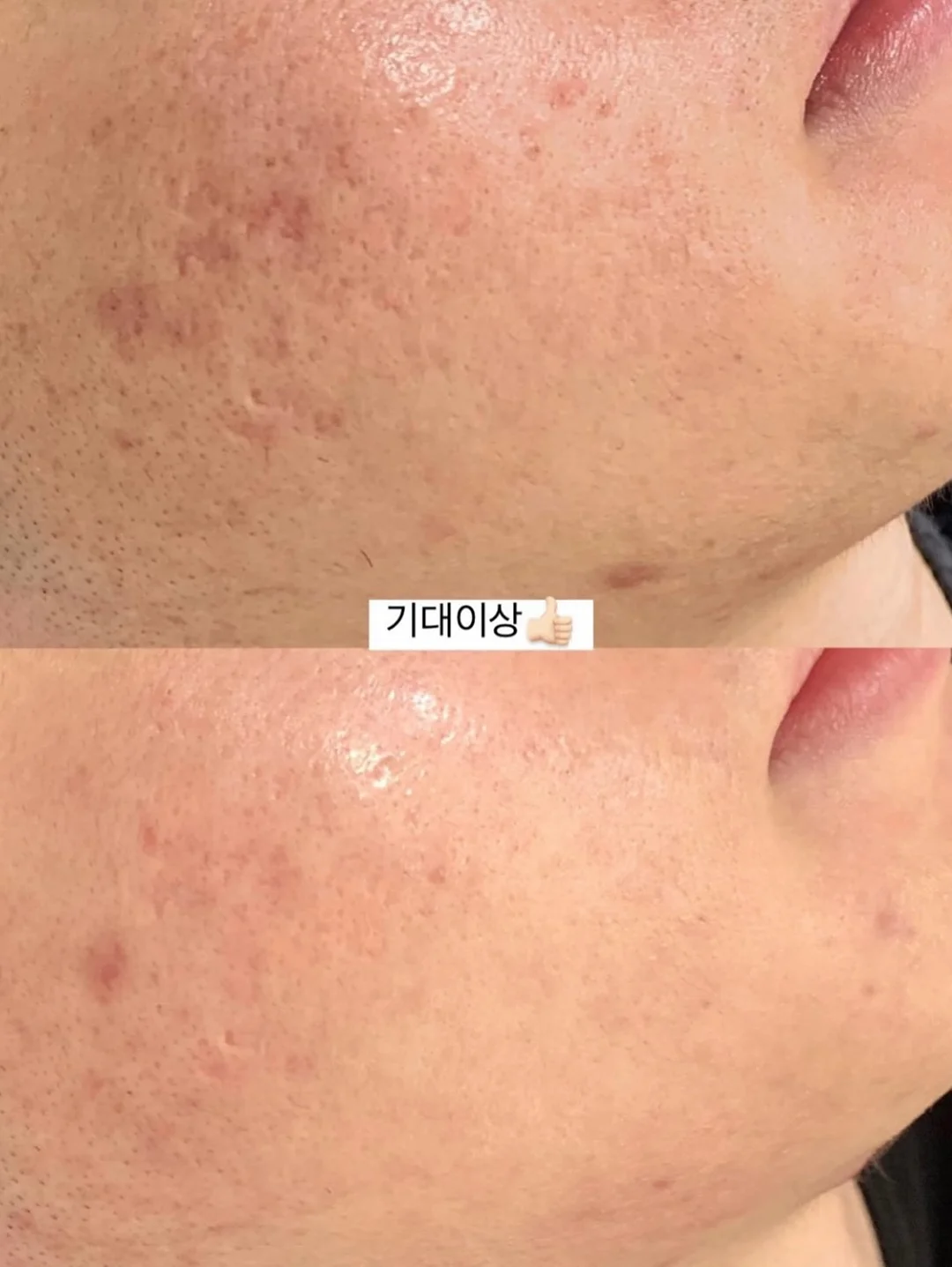욤포켓스튜디오 믹스원석 미아방지팔찌 10