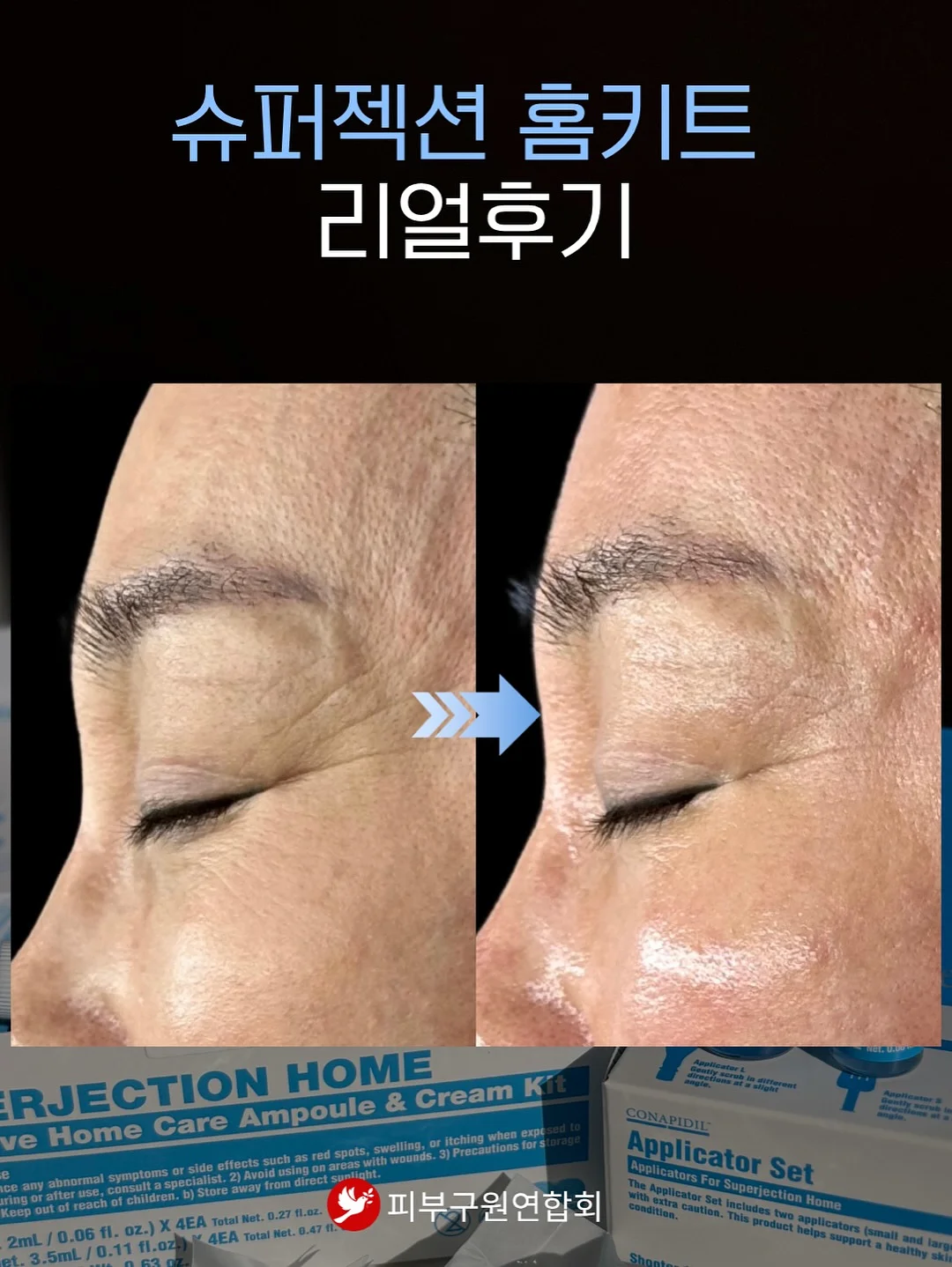 썸머 솔트 스트레이트 데님 11