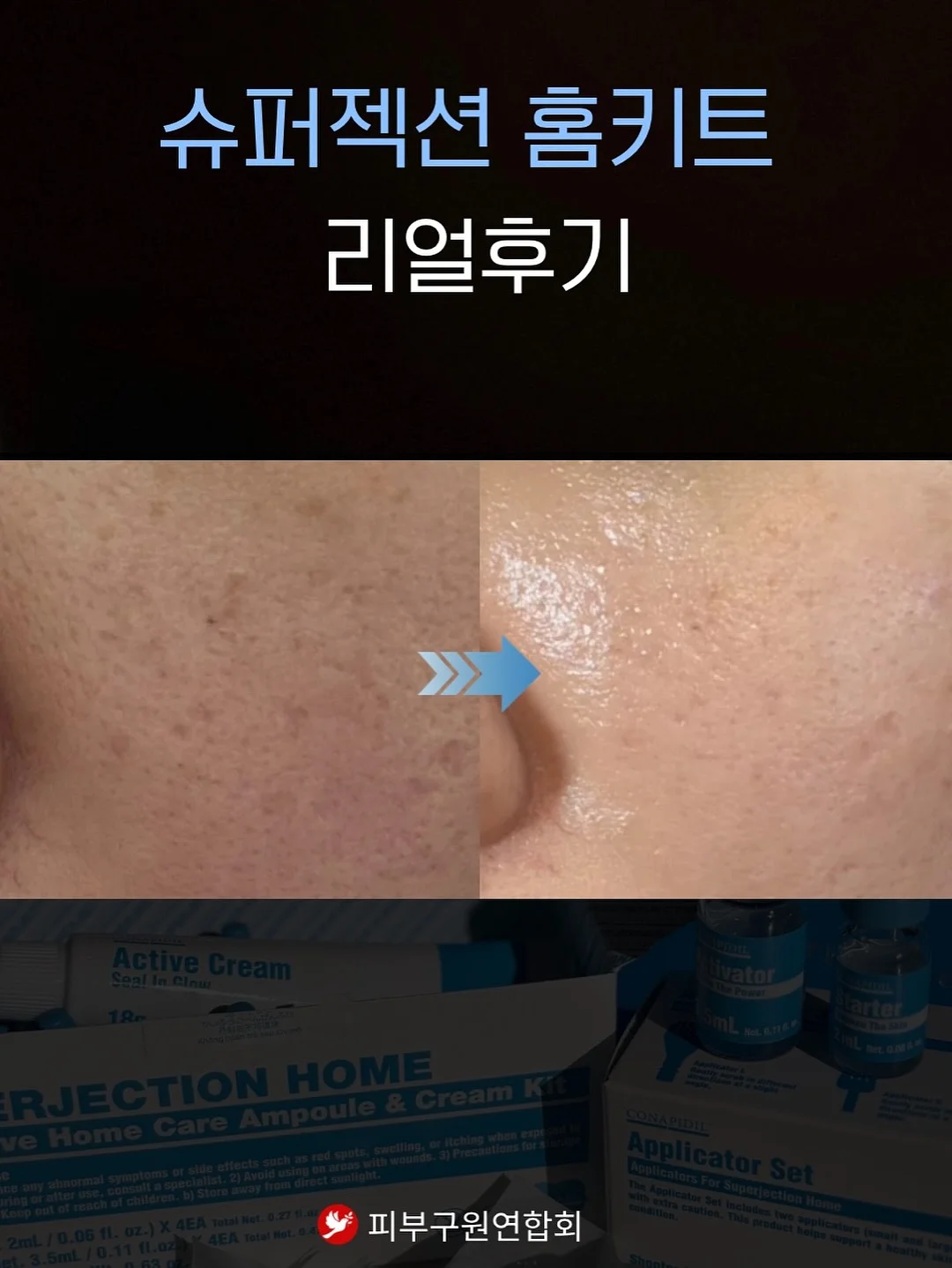 썸머 솔트 스트레이트 데님 12