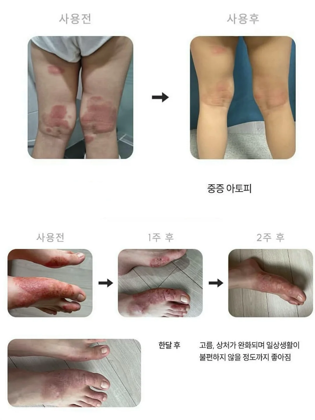 룰루맘 간식 모음 8