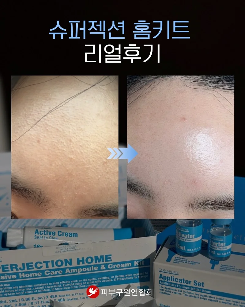 백화점 납품 고퀄 자켓 16