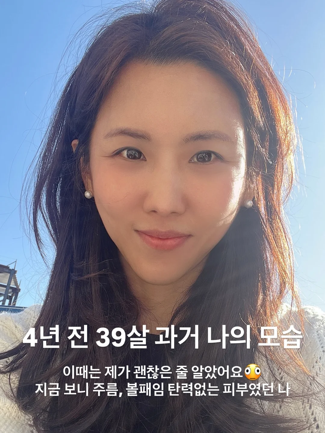 이그니스 멀티매입등 1
