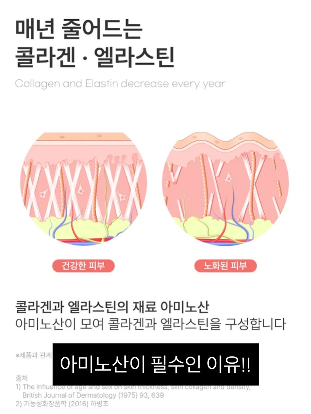 이그니스 멀티매입등 14