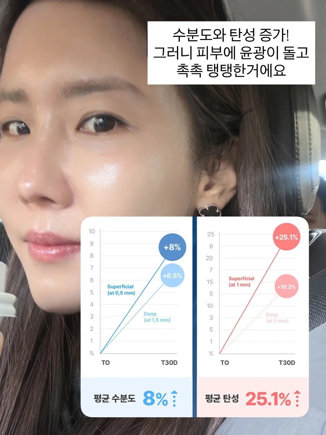 이그니스 멀티매입등 15