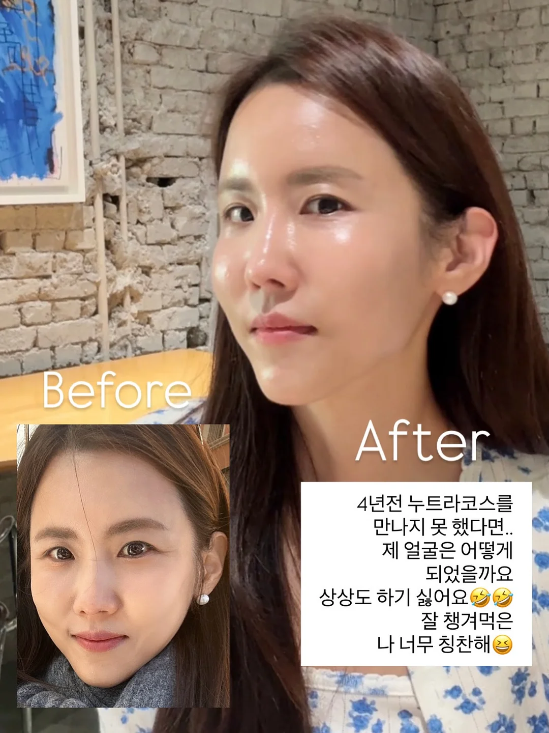 이그니스 멀티매입등 2