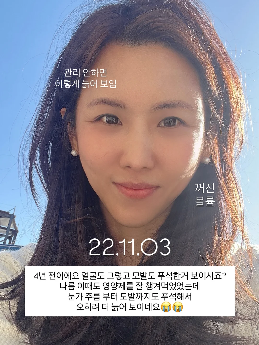 이그니스 멀티매입등 3