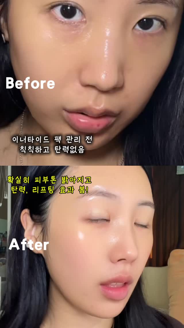 티오톤 악어 배낭