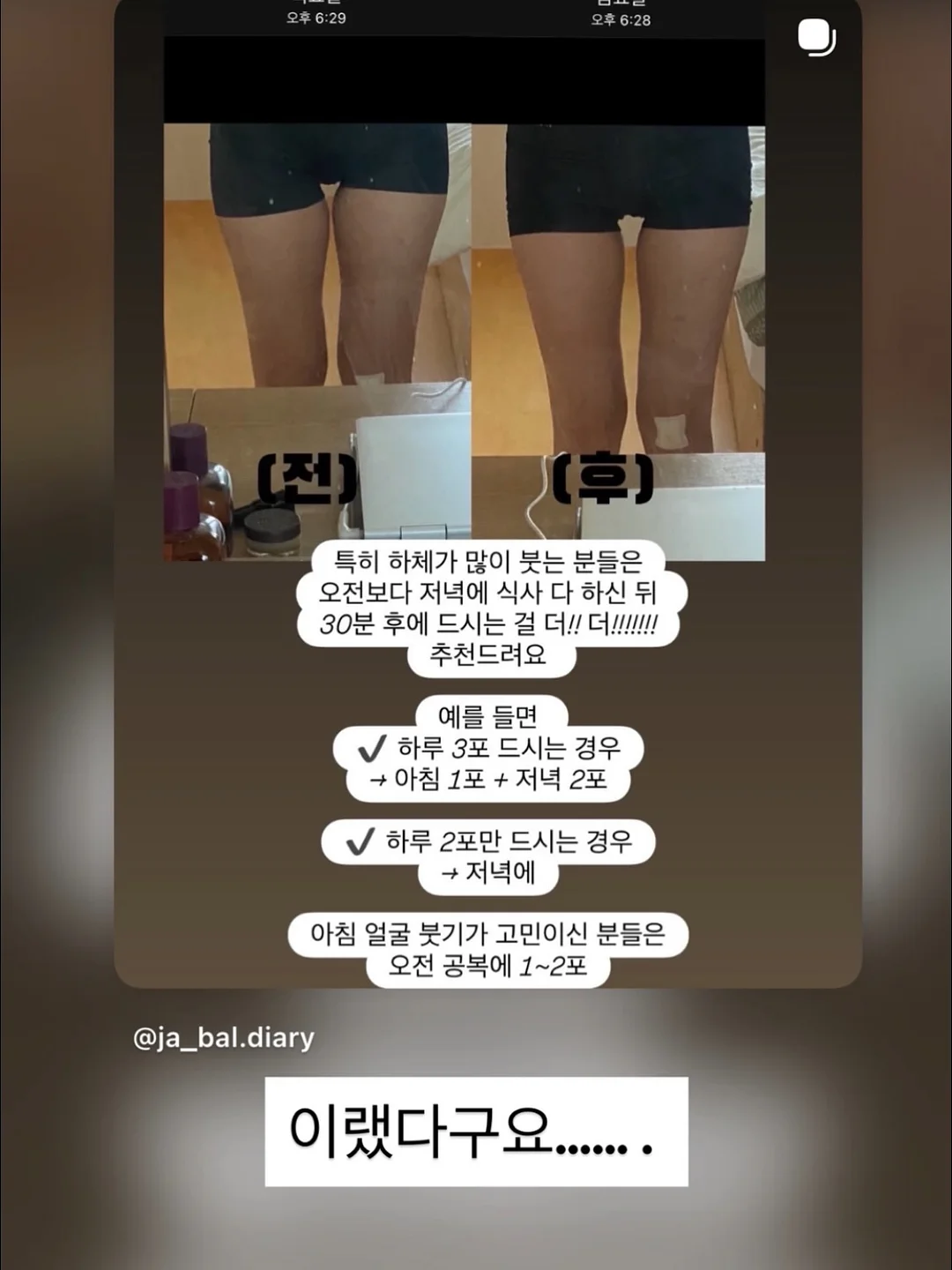 임산부 태교여행룩 원피스 세트 2