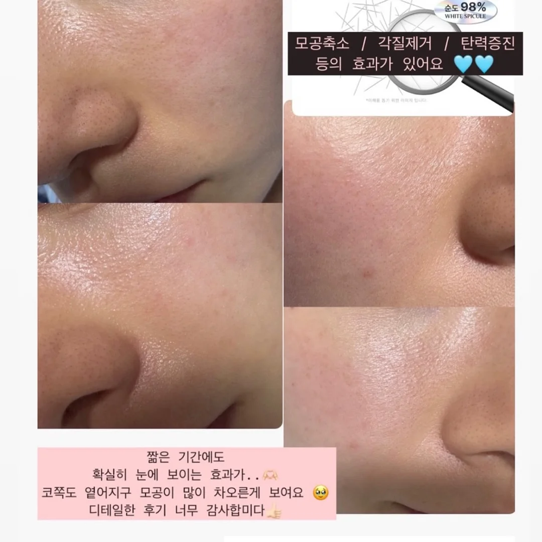 몽벨 가방 10