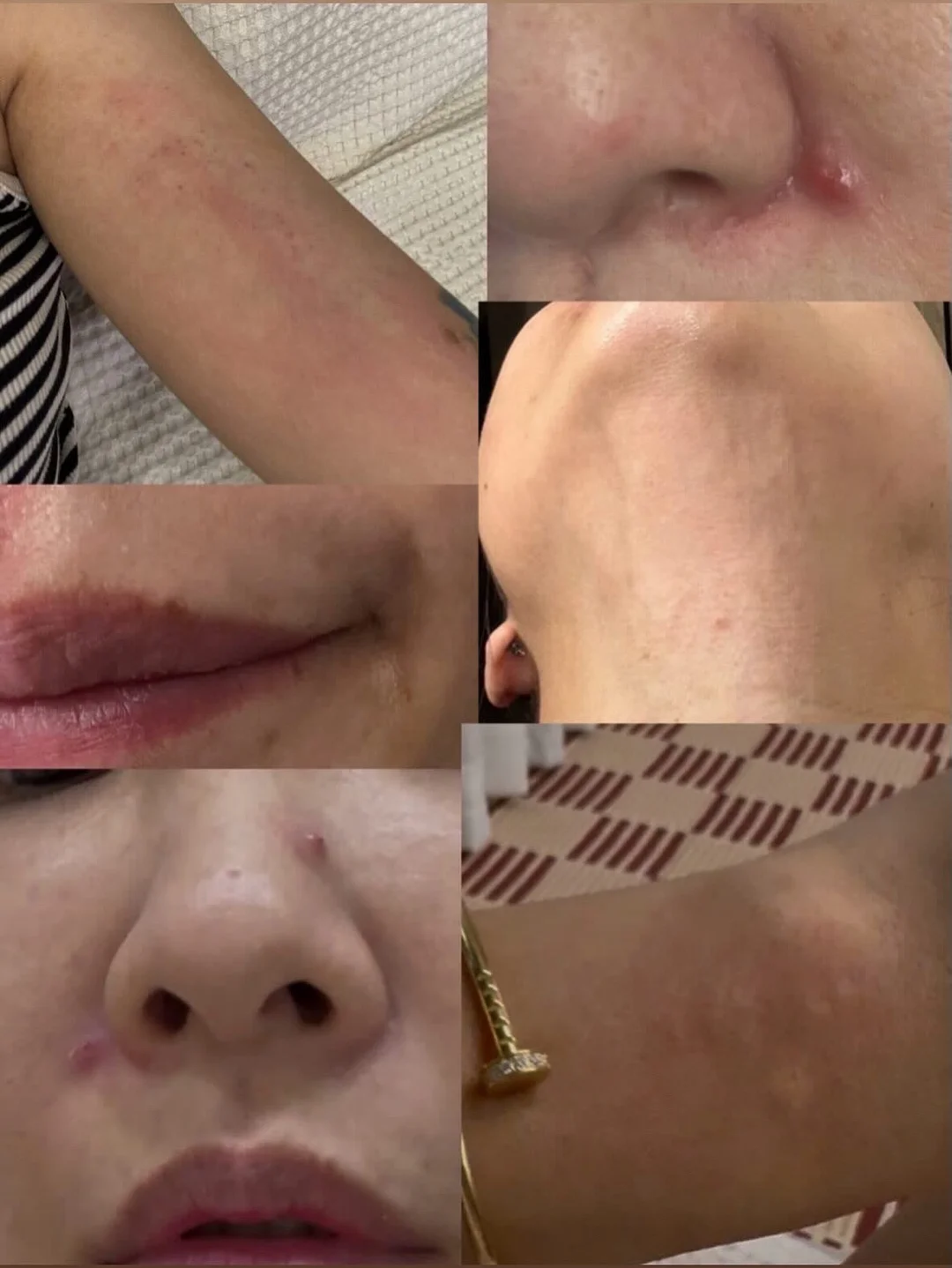 손목 모래주머니 1