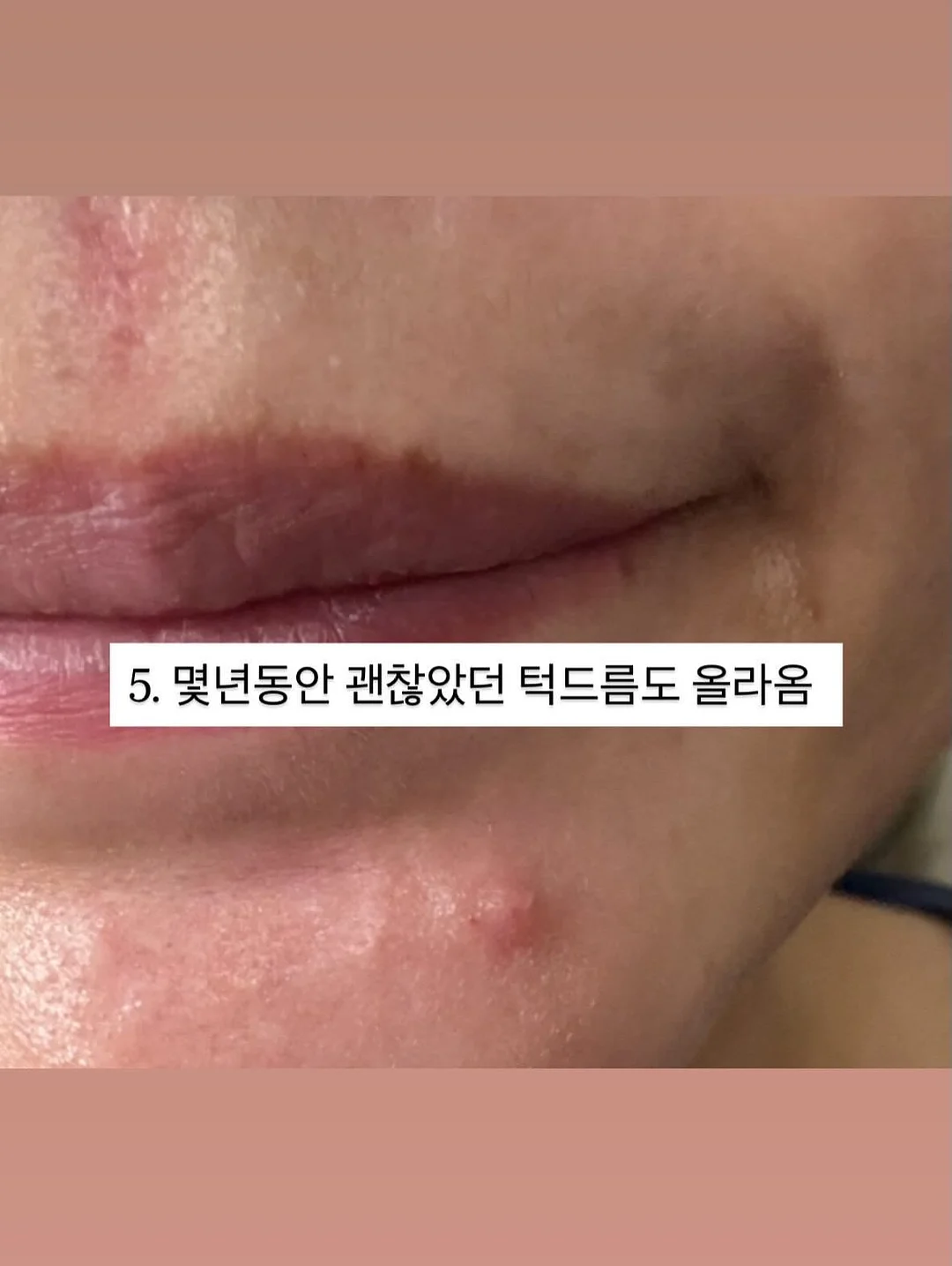 손목 모래주머니 7