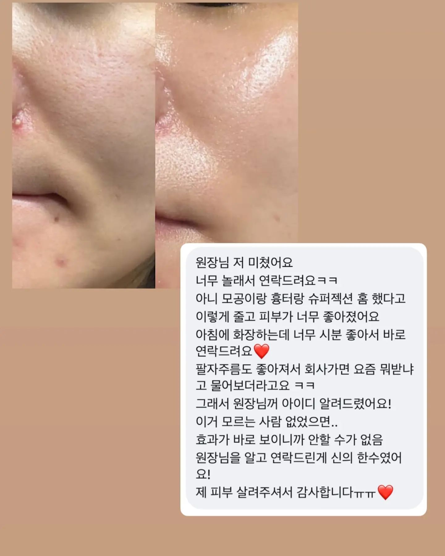 납작파우치 13