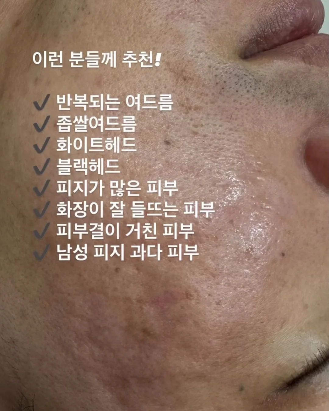 무화과 블러셔 11