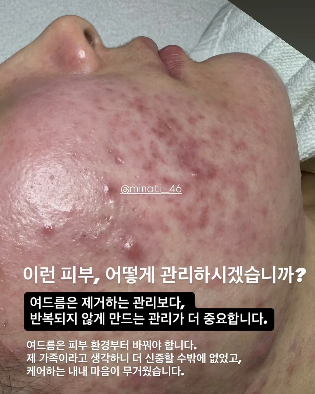 무화과 블러셔 9