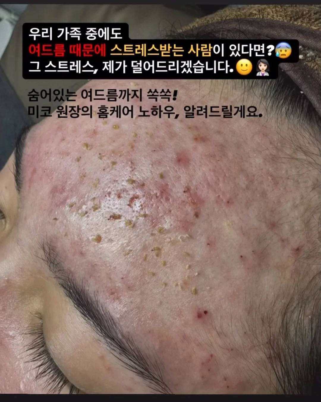 무화과 블러셔 10