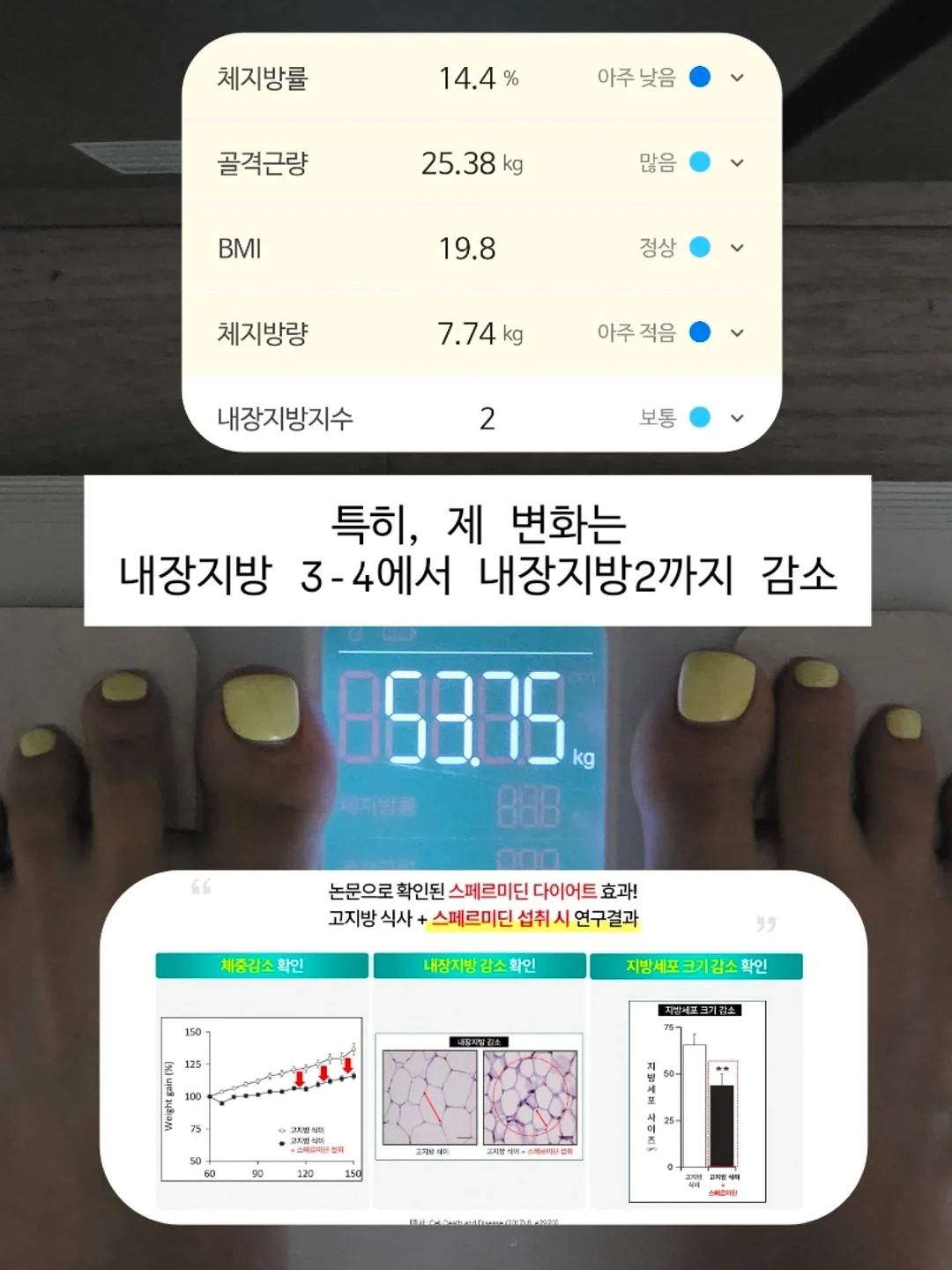 카프리 팬츠 7